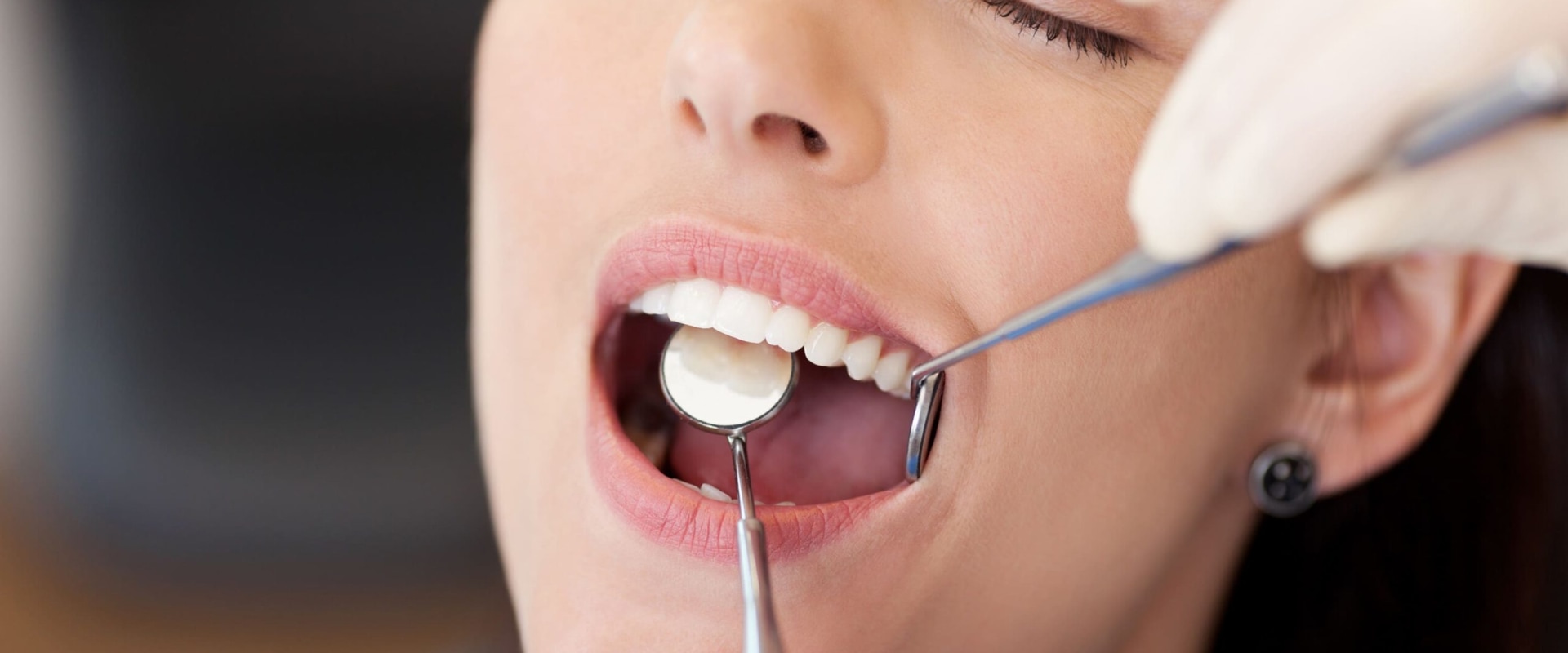 What is the Most Common Dental