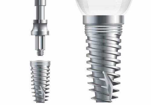 What are the 4 types of implants?